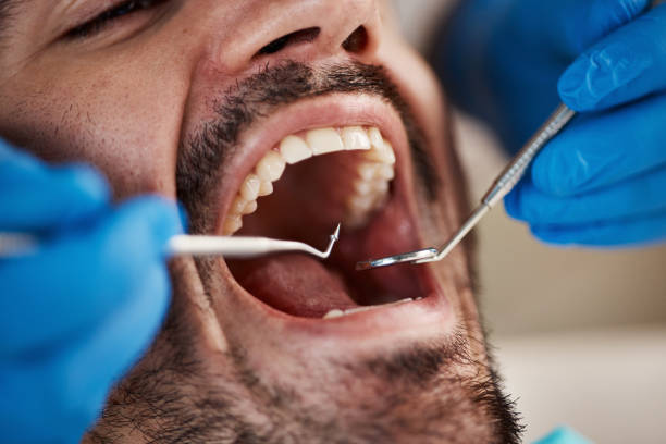 Best Dentist for Tooth Abscess  in Philipsburg, PA